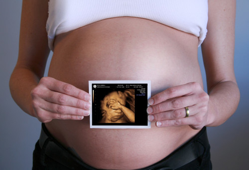Mommies Choice! Mom picks two of her favorite Ultrasound Services for 2 session during your pregnancy